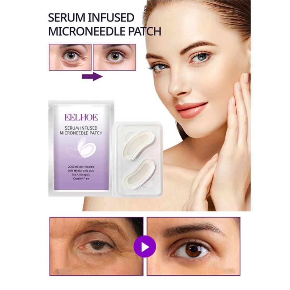 Microneedle Patch Eye - Mikronadel-Augenmasken-Patch, Straffende und Feuchtigkeitsspendende Augenpads zur