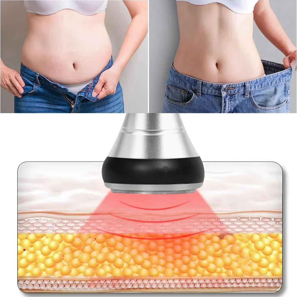 4-in-1 40K Kavitationsgerät Ul – Spa Y Wellness Bewertung und Preis