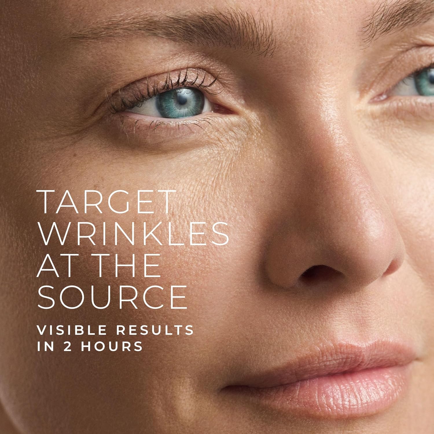 Hyaluronsäure-Retinol-Mikronad – Microneedle Patch Eye Bewertung und Preis
